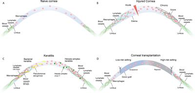 Macrophage-Mediated Tissue Vascularization: Similarities and Differences Between Cornea and Skin